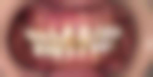 诊疗特色总结：李继闯医生的诊疗方式有何不同？