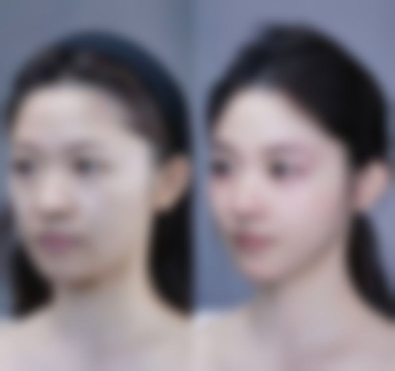减轻眼部疲劳成效
