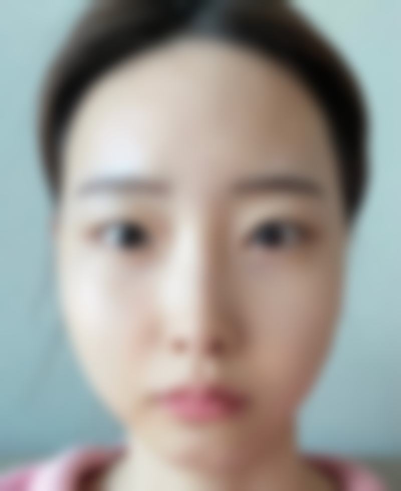 探秘韩国TS整形医院的魅力之旅