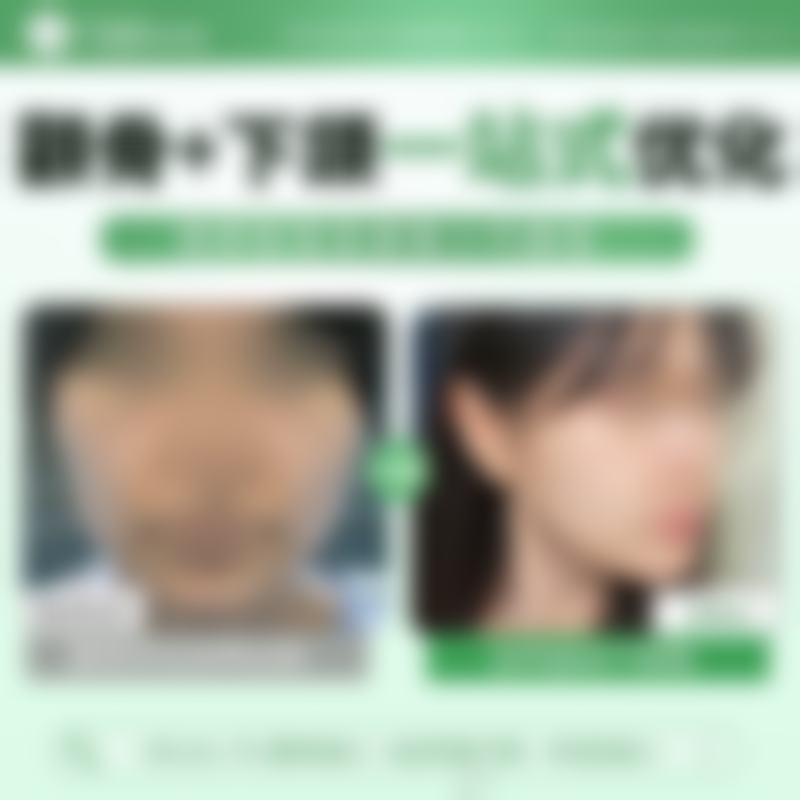 韩国TS整形医院设备与服务