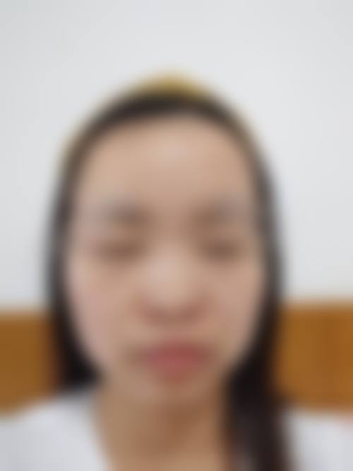 广州百莲凯医疗美容门诊部:贷款消费的陷阱风险