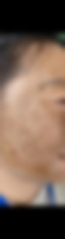 广州百莲凯医疗美容门诊部怎么样？揭秘其虚假宣传与祛斑无效退款纠纷内幕