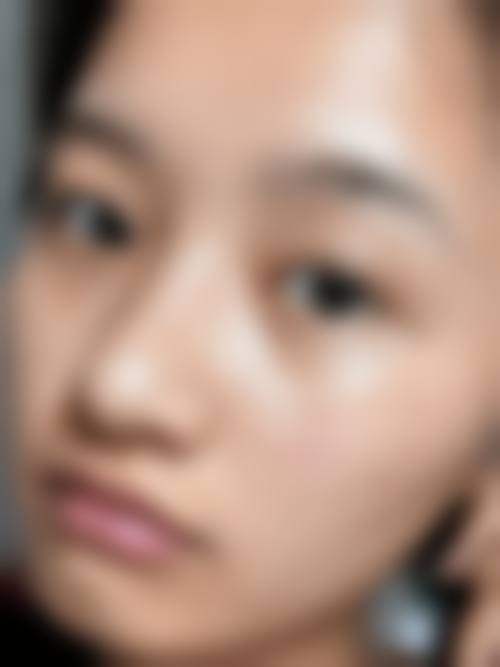 广州百莲凯医疗美容门诊部:祛斑服务背后的真相