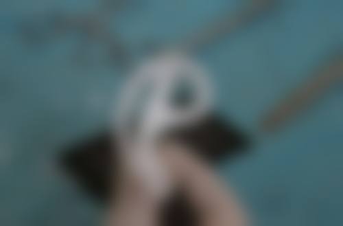 术后护理要点