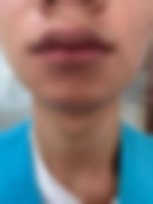 设备环境介绍:进口设备,专精精良