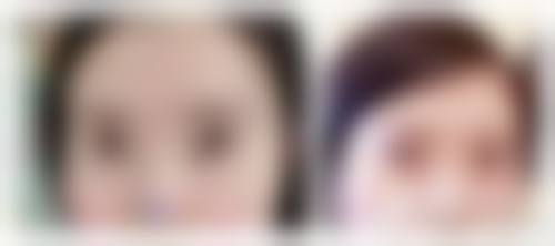 优惠活动详情:高性价比的医疗选择