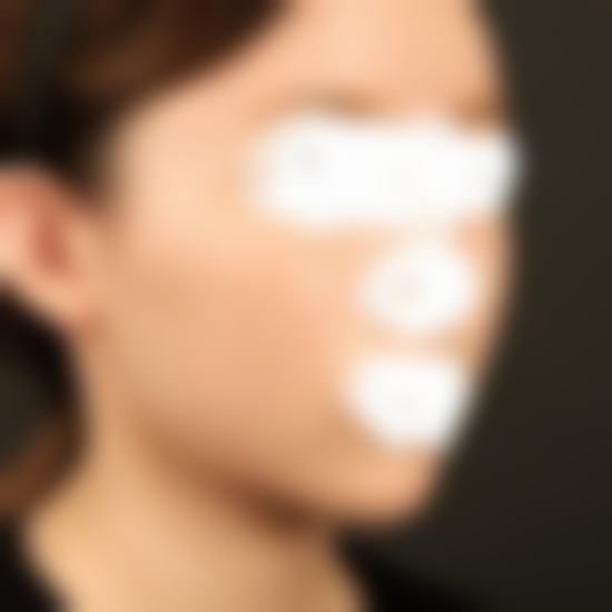 李相均医生的技术优势