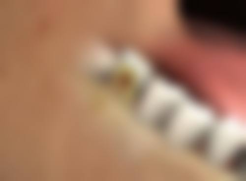 极简双眼皮吊顶