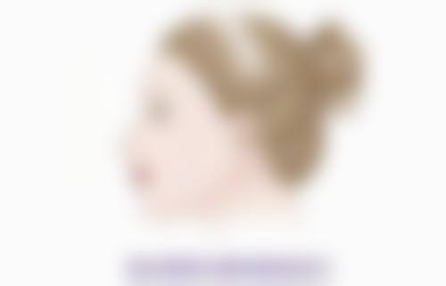 术后初期