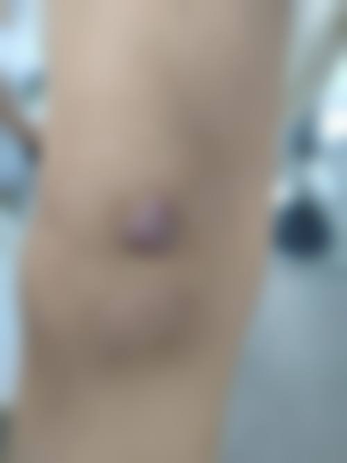 五、选择治疗医院的建议