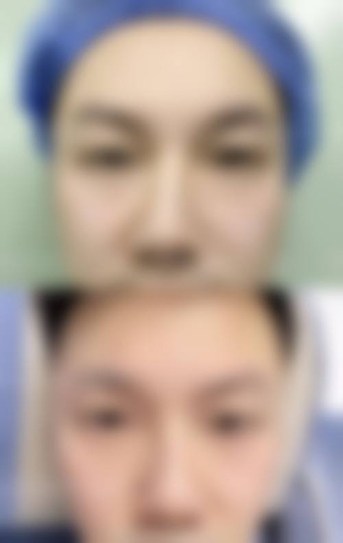 擅长项目详解