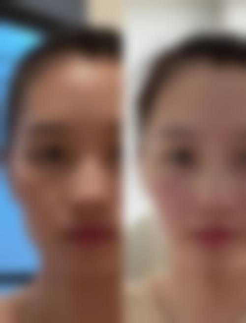 优惠活动详情