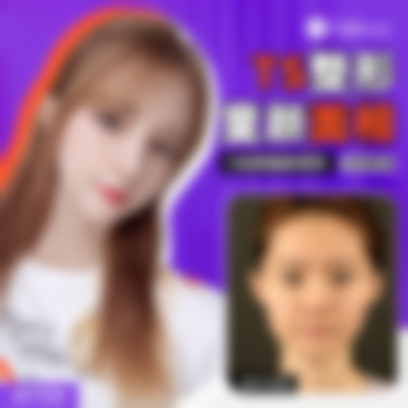 六、常见问题（FAQ）—— 围绕韩国TS整形医院李昇燦个人简历和成就