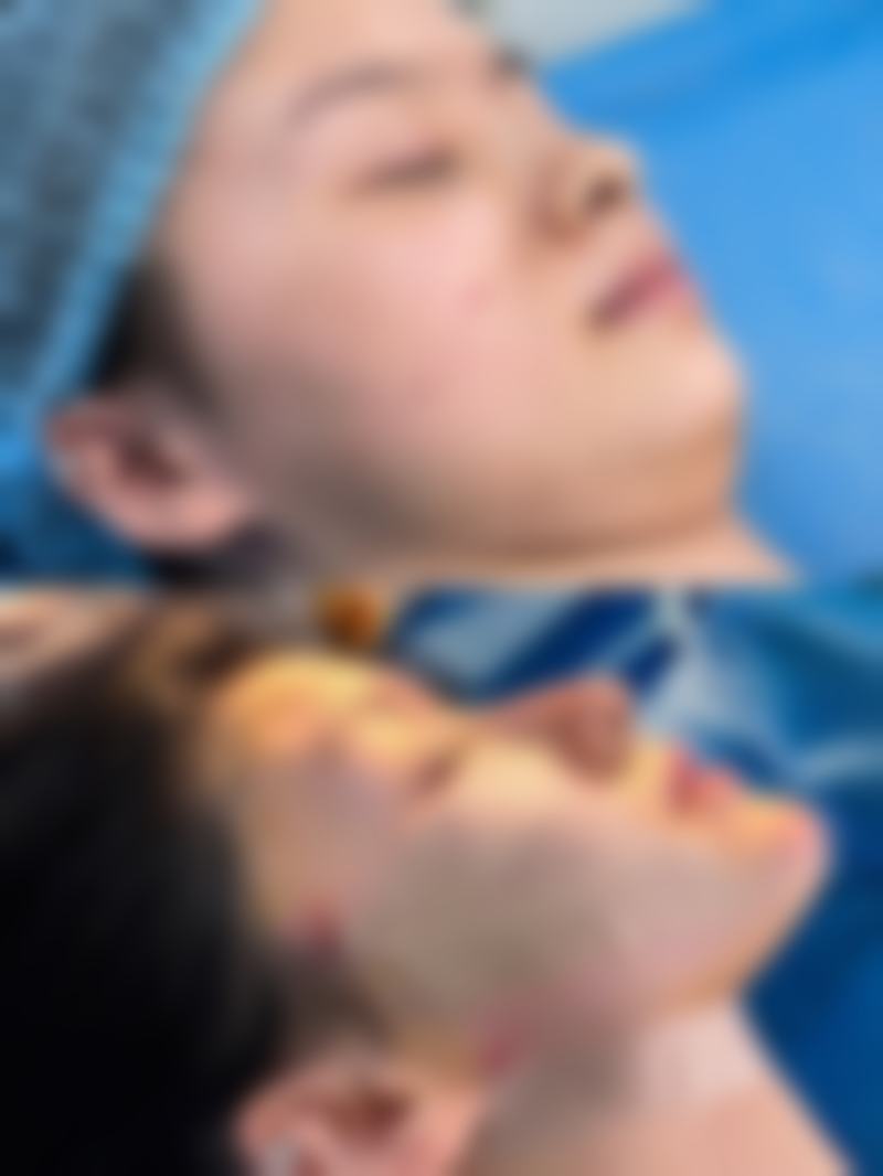 修复中期