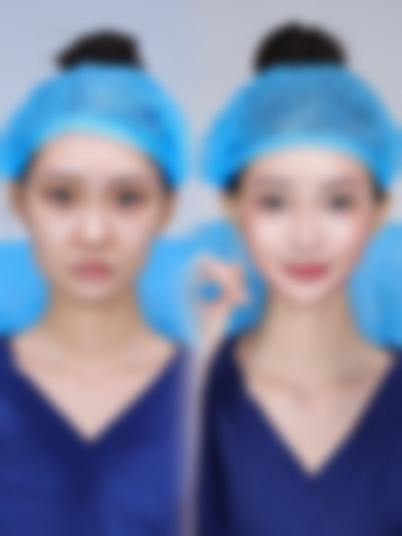 双眼皮吊顶搭配线型灯