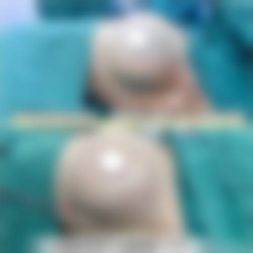 临床实例分享