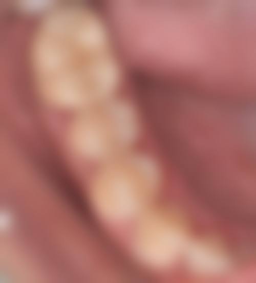 诊疗特色总结:唐小英医生的个性化口腔诊疗