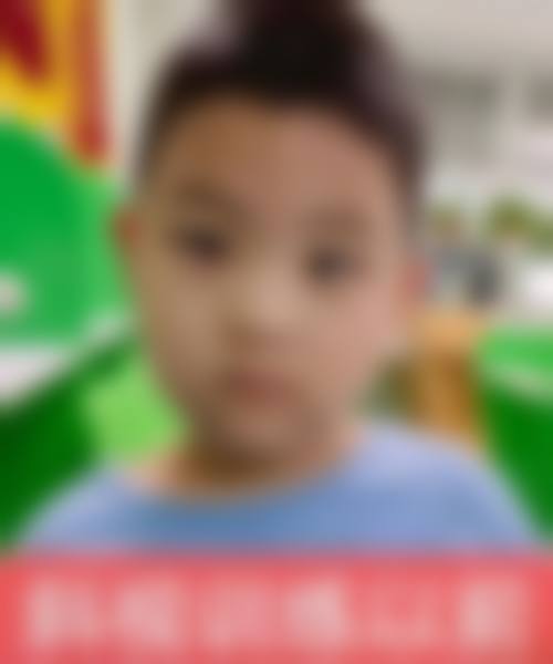 临床实例分享 韩新继 淮南晨光眼科医院