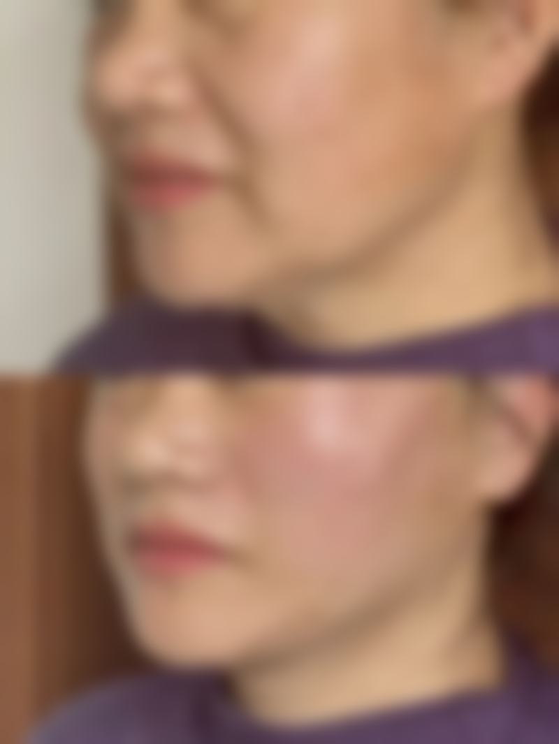 五十多岁男人预防眼袋大的注意事项