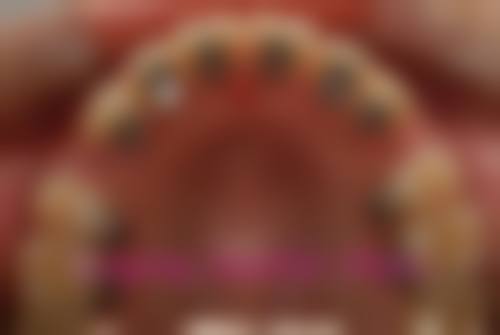 价格透明与优惠活动:让高品质口腔呵护触手及