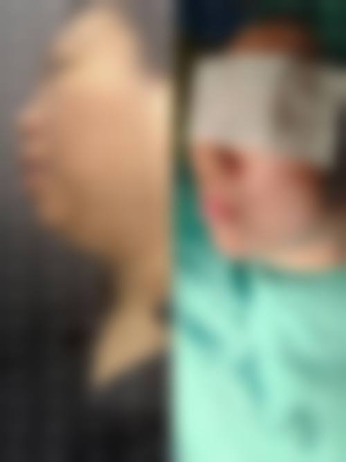 临床实例分享