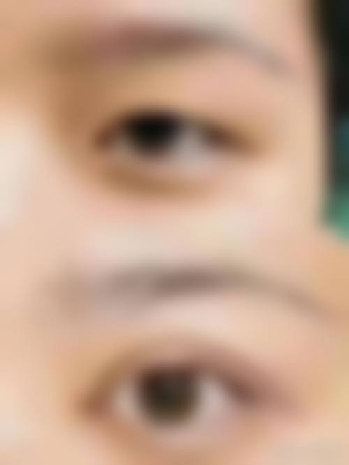 台州维多利亚医疗美容:动态美眼定制的魅力