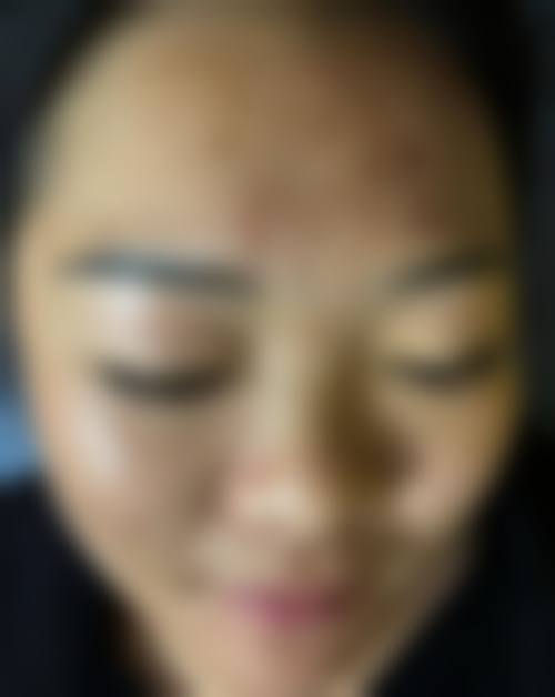 特色技术与项目:解决不同脱发需求的方案
