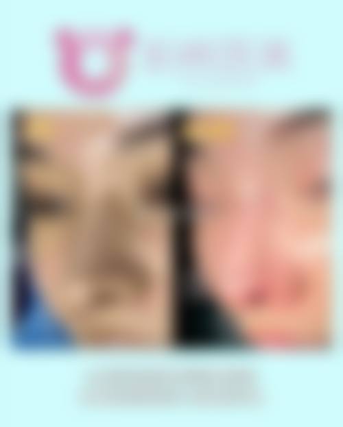预约优惠活动