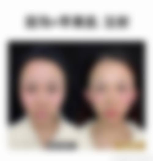 总结与预约号召