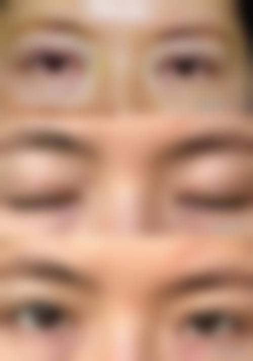 龙岩第一医院整形美容科怎么样？三甲医院，李荣兴等医生技术好，口碑佳！ 