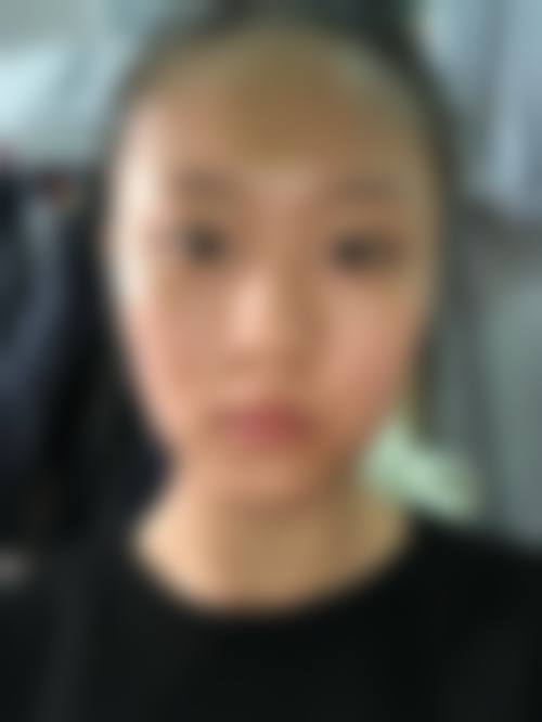 二、肖鹏医生鼻修复的技术优势