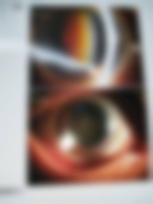 浙江金华爱尔眼科医院有哪些特色诊疗项目？