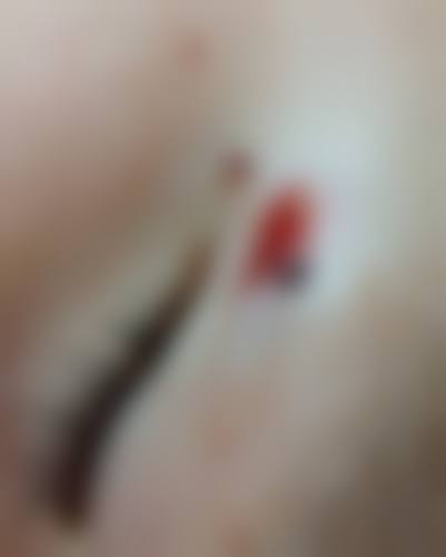 诊疗特色总结