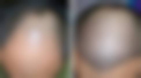临床实例分享