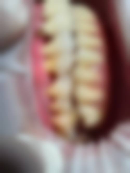 结语：选择正规口腔机构，从奈尔思开始