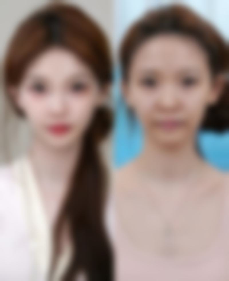 总结：为什么越来越多人选择眉山悦美医疗美容医院？