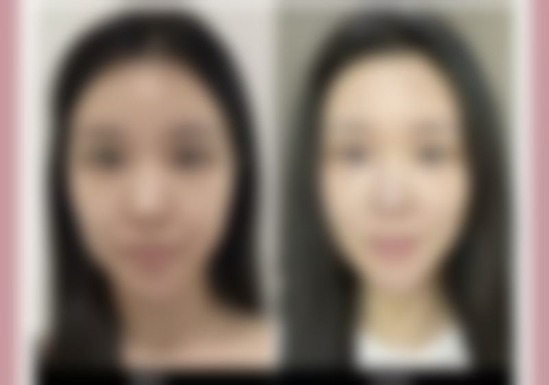 如何预约庆阳润百灵整形医院？